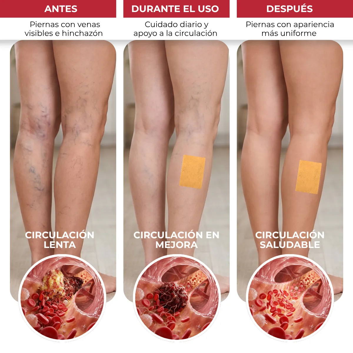 Parches Para Piernas Cansadas Y Venas Varicosas,Tratamiento para Arañas Vasculares y Piernas Cansadas,Alivio de Molestias en Piernas - Imagen 4