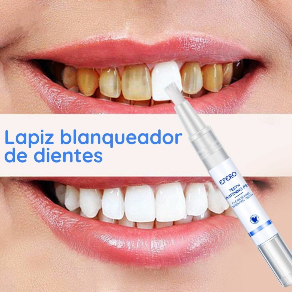 Marcador Blanqueador Para Entresuelas De Zapatillas - Pintura Acrílica Impermeable, Restaura Zapatos Blancos