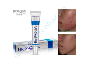 Acné Bioaqua - UniversoEnLinea